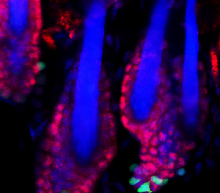 Did Lyme disease come from Plum Island 广州圣凯斯化工科技有限公司